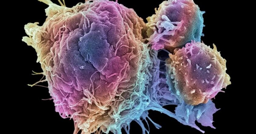 ‘Immunotherapy’ aiming the better treatment way to heal cancer cell