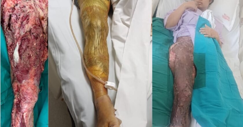 Innovative traumacare at Amrita Hospital sets new benchmark, highlights healthcare needs in Northeast